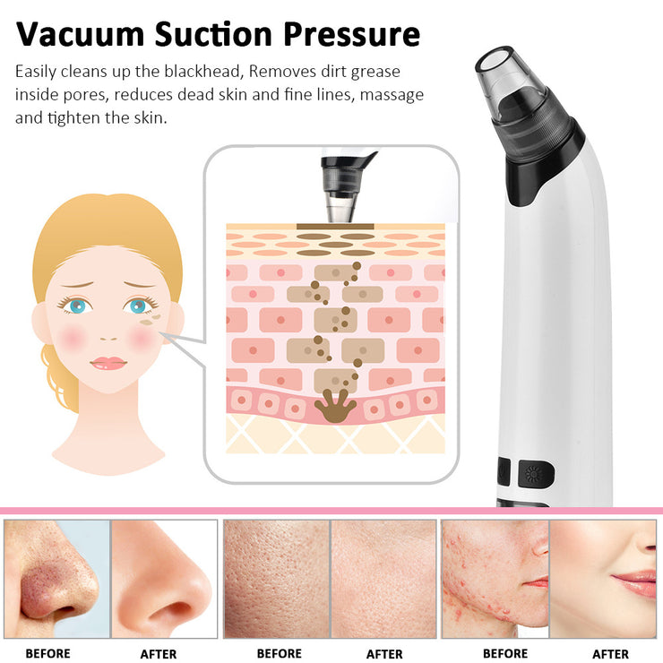 Heating Blackhead Instrument HailiCare Clean Pore Vacuum Cleansing Acne Acne Beauty Instrument