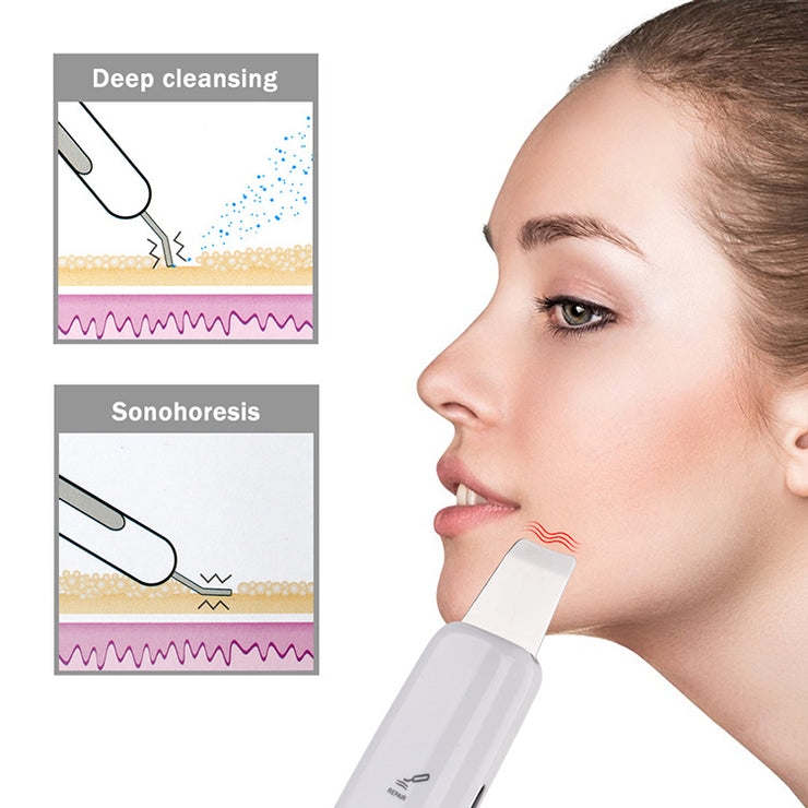 HailiCare Facial Ultrasonic Peeling Machine Deep Cleans Dead Skin Cleansing Machine to Remove Blackheads