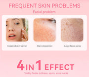 4 In 1 Hyaluronic Acid Serum Anti Aging Niacinamide Serum Facial products - Follow yourDream